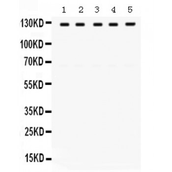 TRPM8 Antibody - TRPM8 antibody Western blot. All lanes: Anti TRPM8 at 0.5 ug/ml. Lane 1: HELA Whole Cell Lysate at 40 ug. Lane 2: 22RV1 Whole Cell Lysate at 40 ug. Lane 3: SW620 Whole Cell Lysate at 40 ug. Lane 4: A549 Whole Cell Lysate at 40 ug. Lane 5: A431 Whole Cell Lysate at 40 ug. Predicted band size: 127 kD. Observed band size: 127 kD.