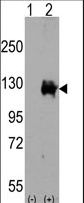 TRPM8 Antibody - Western blot of TRPM8 (arrow) using rabbit polyclonal TRPM8 Antibody. 293 cell lysates (2 ug/lane) either nontransfected (Lane 1) or transiently transfected with the TRPM8 gene (Lane 2) (Origene Technologies).