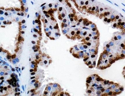 TRPM8 Antibody - Immunohistochemistry: TRPM8 Antibody - IHC analysis of TRPM8 in mouse prostate using DAB with hematoxylin counterstain.  This image was taken for the unconjugated form of this product. Other forms have not been tested.