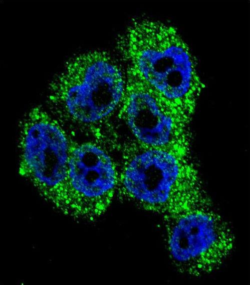 TRPM8 Antibody - Confocal immunofluorescence of TRPM8 Antibody with A375 cell followed by Alexa Fluor 488-conjugated goat anti-rabbit lgG (green). DAPI was used to stain the cell nuclear (blue).