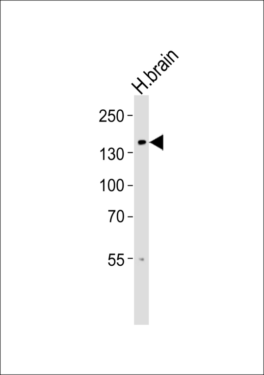 TRPM8 Antibody - Western blot of lysate from human brain tissue lysate, using TRPM8 Antibody (Center R536). Antibody was diluted at 1:1000. A goat anti-rabbit IgG H&L (HRP) at 1:5000 dilution was used as the secondary antibody. Lysate at 35ug.