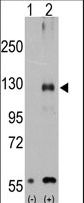 TRPM8 Antibody - Western blot of TRPM8 (arrow) using rabbit polyclonal TRPM8 Antibody (Center R536). 293 cell lysates (2 ug/lane) either nontransfected (Lane 1) or transiently transfected with the TRPM8 gene (Lane 2) (Origene Technologies).