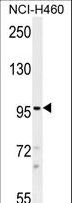 TRPM8 Antibody - TRPM8 Antibody western blot of NCI-H460 cell line lysates (35 ug/lane). The TRPM8 antibody detected the TRPM8 protein (arrow).