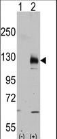 TRPM8 Antibody - Western blot of TRPM8 (arrow) using rabbit polyclonal TRPM8 Antibody (C-term C940). 293 cell lysates (2 ug/lane) either nontransfected (Lane 1) or transiently transfected with the TRPM8 gene (Lane 2) (Origene Technologies).
