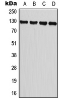 TRPM8 Antibody - Western blot analysis of TRPM8 expression in A549 (A); PC3 (B); NIH3T3 (C); H9C2 (D) whole cell lysates.