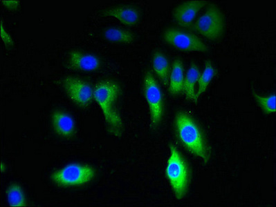 TRPM8 Antibody - Immunofluorescent analysis of A549 cells using TRPM8 Antibody at dilution of 1:100 and Alexa Fluor 488-congugated AffiniPure Goat Anti-Rabbit IgG(H+L)