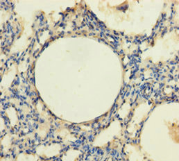 TRPM8 Antibody - Immunohistochemistry of paraffin-embedded human lung tissue using TRPM8 Antibody at dilution of 1:100