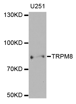 TRPM8 Antibody - Western blot analysis of extracts of U251 cells.