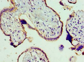TRPM8 Antibody - Immunohistochemistry of paraffin-embedded human placenta tissue at dilution 1:100