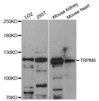 TRPM8 Antibody - Western blot analysis of extracts of various cell lines, using TRPM8 antibody at 1:3000 dilution. The secondary antibody used was an HRP Goat Anti-Rabbit IgG (H+L) at 1:10000 dilution. Lysates were loaded 25ug per lane and 3% nonfat dry milk in TBST was used for blocking. An ECL Kit was used for detection and the exposure time was 60s.