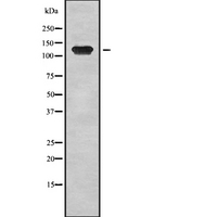 TRPM8 Antibody - Western blot analysis of TRPM8 using COS7 whole lysates.