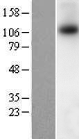 TRPM8 Protein - Western validation with an anti-DDK antibody * L: Control HEK293 lysate R: Over-expression lysate