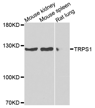 TRPS1 Antibody - Western blot analysis of extracts of various cells.