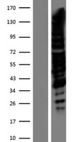 TRPS1 Protein - Western validation with an anti-DDK antibody * L: Control HEK293 lysate R: Over-expression lysate