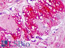 TRPV3 Antibody - Anti-TRPV3 antibody IHC of human colon, ganglion. Immunohistochemistry of formalin-fixed, paraffin-embedded tissue after heat-induced antigen retrieval. Antibody concentration 10 ug/ml.  This image was taken for the unconjugated form of this product. Other forms have not been tested.