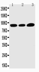 TRPV3 Antibody - WB of TRPV3 antibody. Lane 1: HELA Cell Lysate. Lane 2: A549 Cell Lysate. Lane 3: MCF-7 Cell Lysate.