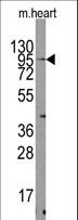 TRPV3 Antibody - Western blot of TRPV3 Antibody in mouse heart tissue lysates (35 ug/lane). TRPV3(arrow) was detected using the purified antibody.