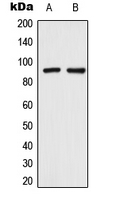 TRPV3 Antibody - Western blot analysis of TRPV3 expression in HeLa (A); SHSY5Y (B) whole cell lysates.