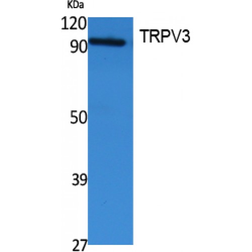 TRPV3 Antibody - Western blot of TRPV3 antibody