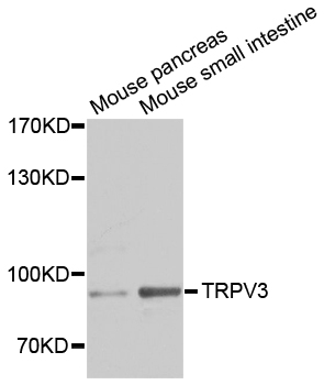 TRPV3 Antibody - Western blot analysis of extracts of various cell lines.