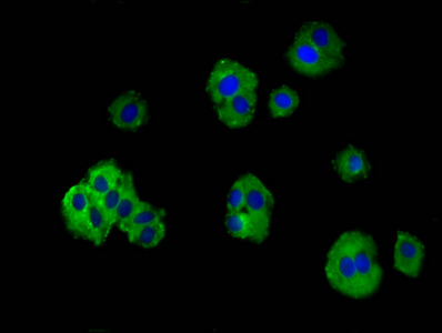 TRPV3 Antibody - Immunofluorescence staining of HepG2 cells diluted at 1:100, counter-stained with DAPI. The cells were fixed in 4% formaldehyde, permeabilized using 0.2% Triton X-100 and blocked in 10% normal Goat Serum. The cells were then incubated with the antibody overnight at 4°C.The Secondary antibody was Alexa Fluor 488-congugated AffiniPure Goat Anti-Rabbit IgG (H+L).