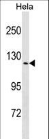 TRPV4 Antibody - TRPV4 Antibody western blot of HeLa cell line lysates (35 ug/lane). The TRPV4 antibody detected the TRPV4 protein (arrow).