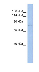 TRPV4 Antibody - TRPV4 antibody Western blot of ACHN lysate. This image was taken for the unconjugated form of this product. Other forms have not been tested.