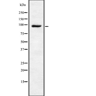 TRPV4 Antibody - Western blot analysis of TRPV4 using HeLa whole cells lysates