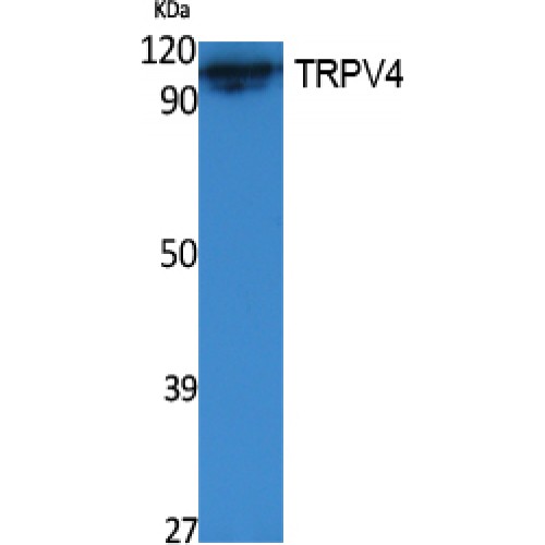 TRPV4 Antibody - Western blot of TRPV4 antibody