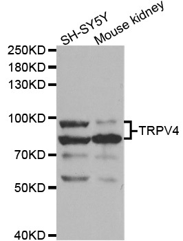 TRPV4 Antibody - Western blot analysis of extracts of various cell lines.
