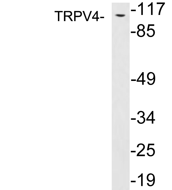 TRPV4 Antibody - Western blot analysis of lysates from PC12 cells, using TRPV4 antibody.