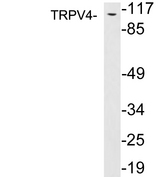 TRPV4 Antibody - Western blot analysis of lysates from PC12 cells, using TRPV4 antibody.