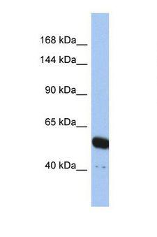 TRPV4 Antibody - Western blot of Human HT1080. TRPV4 antibody dilution 1.0 ug/ml.  This image was taken for the unconjugated form of this product. Other forms have not been tested.