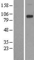 TRPV4 Protein - Western validation with an anti-DDK antibody * L: Control HEK293 lysate R: Over-expression lysate