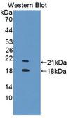 TRPV6 Antibody - Western blot of TRPV6 antibody.