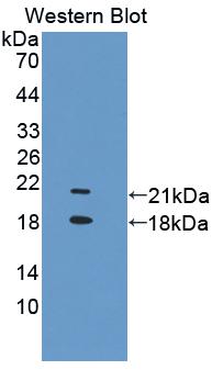 TRPV6 Antibody - Western blot of TRPV6 antibody.