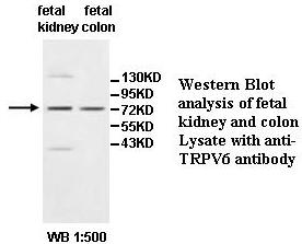TRPV6 Antibody
