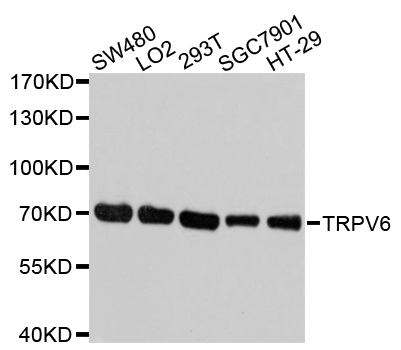 TRPV6 Antibody - Western blot analysis of extracts of various cell lines, using TRPV6 antibody at 1:1000 dilution. The secondary antibody used was an HRP Goat Anti-Rabbit IgG (H+L) at 1:10000 dilution. Lysates were loaded 25ug per lane and 3% nonfat dry milk in TBST was used for blocking. An ECL Kit was used for detection and the exposure time was 1s.
