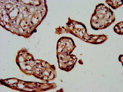 TRPV6 Antibody - Immunohistochemistry image at a dilution of 1:300 and staining in paraffin-embedded human placenta tissue performed on a Leica BondTM system. After dewaxing and hydration, antigen retrieval was mediated by high pressure in a citrate buffer (pH 6.0) . Section was blocked with 10% normal goat serum 30min at RT. Then primary antibody (1% BSA) was incubated at 4 °C overnight. The primary is detected by a biotinylated secondary antibody and visualized using an HRP conjugated SP system.