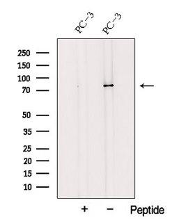 TRPV6 Antibody - Western blot analysis of extracts of PC-3 cells using TRPV6 antibody. The lane on the left was treated with blocking peptide.
