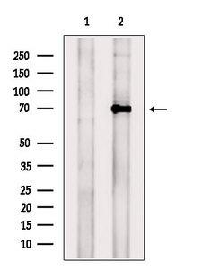 TRPV6 Antibody