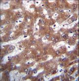 TRUB1 Antibody - TRUB1 Antibody immunohistochemistry of formalin-fixed and paraffin-embedded human liver tissue followed by peroxidase-conjugated secondary antibody and DAB staining.