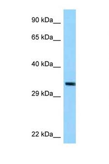 TRUB1 Antibody - TRUB1 antibody Western blot of ACHN Cell lysate. Antibody concentration 1 ug/ml.  This image was taken for the unconjugated form of this product. Other forms have not been tested.
