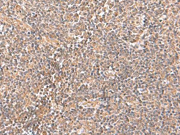 TRUB1 Antibody - Immunohistochemistry of paraffin-embedded Human tonsil tissue  using TRUB1 Polyclonal Antibody at dilution of 1:70(×200)