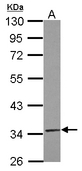 TRUB2 Antibody - Sample (30 ug of whole cell lysate) A: IMR32 10% SDS PAGE TRUB2 antibody diluted at 1:500