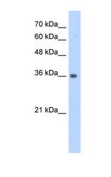 TRUB2 Antibody - HepG2 cell lysate. Antibody concentration: 1.0 ug/ml. Gel concentration: 12%.  This image was taken for the unconjugated form of this product. Other forms have not been tested.