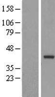 TRUB2 Protein - Western validation with an anti-DDK antibody * L: Control HEK293 lysate R: Over-expression lysate