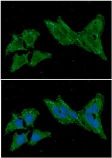trxC / Thioredoxin 2 Antibody - ICC/IF analysis of TXN2 in HeLa cells line, stained with DAPI (Blue) for nucleus staining and monoclonal anti-human TXN2 antibody (1:100) with goat anti-mouse IgG-Alexa fluor 488 conjugate (Green).
