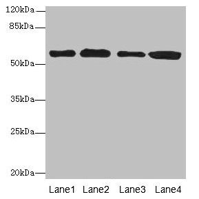 TRXR1 / TXNRD1 Antibody - Western blot All lanes: TXNRD1 antibody at 5µg/ml Lane 1: Jurkat whole cell lysate Lane 2: A549 whole cell lysate Lane 3: MCF-7 whole cell lysate Lane 4: Hela whole cell lysate Secondary Goat polyclonal to rabbit IgG at 1/10000 dilution Predicted band size: 71, 60, 66, 61, 55, 68, 51 kDa Observed band size: 60 kDa