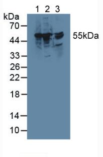 TRXR1 / TXNRD1 Antibody - Western Blot; Sample: Lane1: Rat Liver Tissue; Lane2: Mouse RAW 264.7 Cells; Lane3: Rat Brain Tissue.